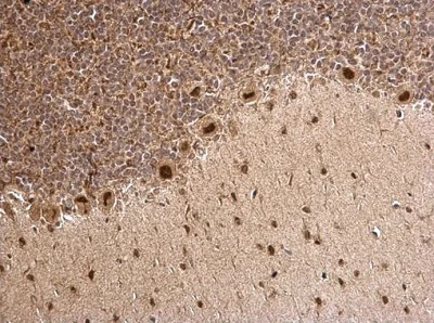 Immunohistochemistry (Formalin/PFA-fixed paraffin-embedded sections) - Anti-MTA1 antibody (AB226960)