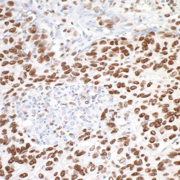 Immunohistochemistry (Formalin/PFA-fixed paraffin-embedded sections) - Anti-MTA1 antibody (AB71153)