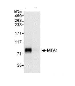 Immunoprecipitation - Anti-MTA1 antibody (AB71153)