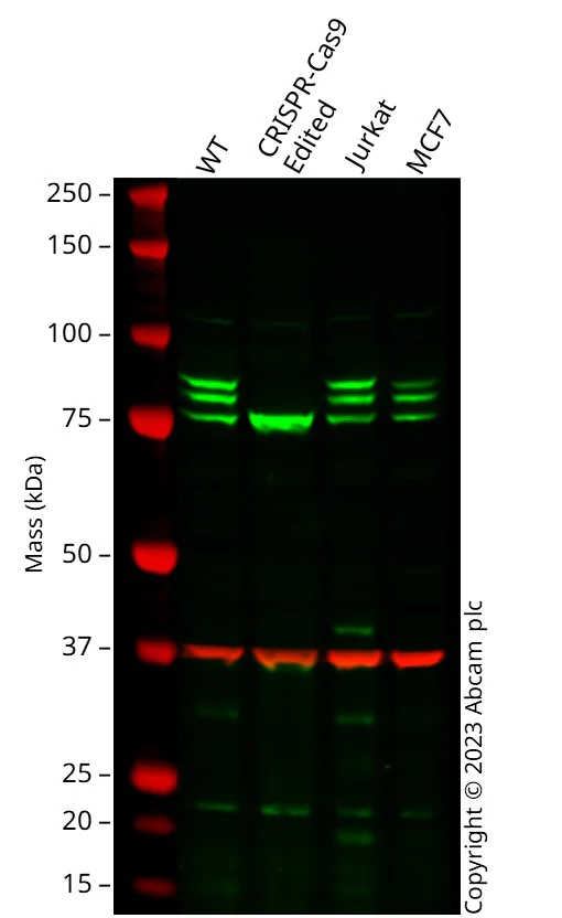 Western blot - Anti-MTA1 antibody (AB71153)