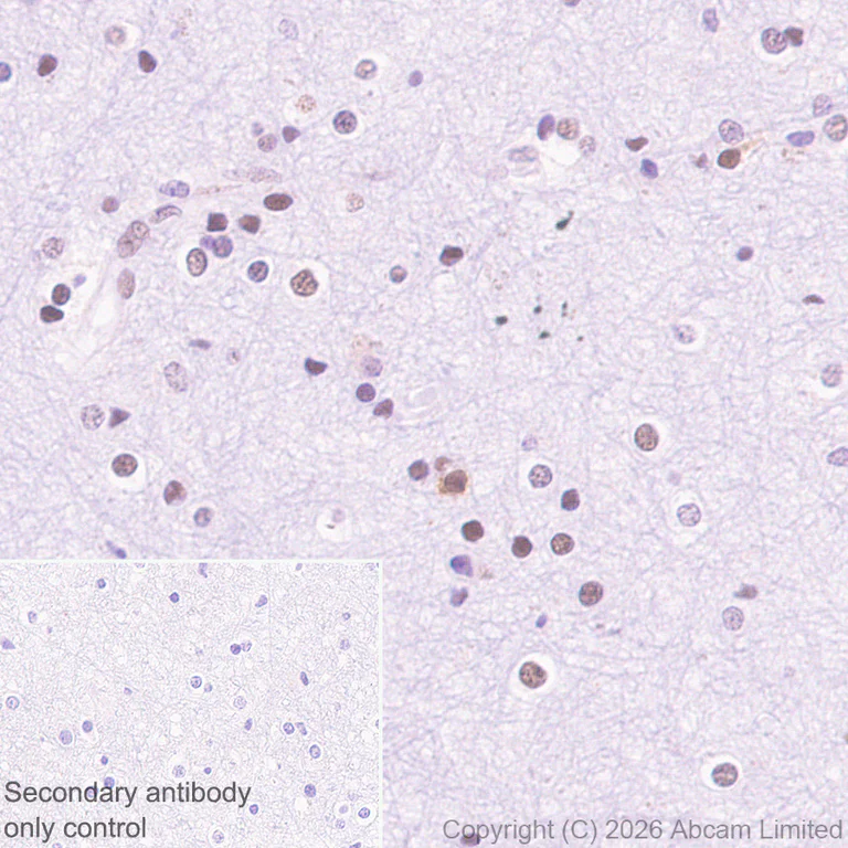 Immunohistochemistry (Formalin/PFA-fixed paraffin-embedded sections) - Anti-MTA1 antibody [EPR26320-543] (AB326880)