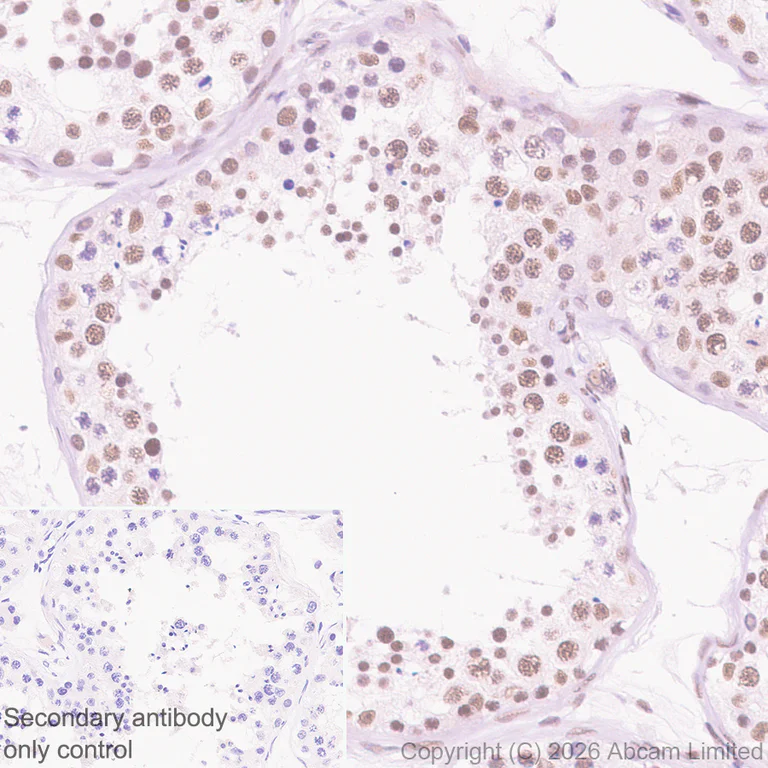 Immunohistochemistry (Formalin/PFA-fixed paraffin-embedded sections) - Anti-MTA1 antibody [EPR26320-543] (AB326880)