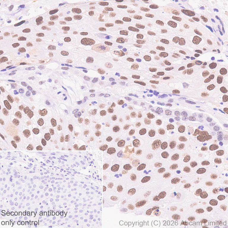 Immunohistochemistry (Formalin/PFA-fixed paraffin-embedded sections) - Anti-MTA1 antibody [EPR26320-543] (AB326880)