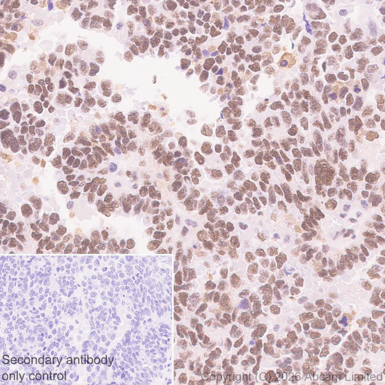 Immunohistochemistry (Formalin/PFA-fixed paraffin-embedded sections) - Anti-MTA1 antibody [EPR26320-543] (AB326880)
