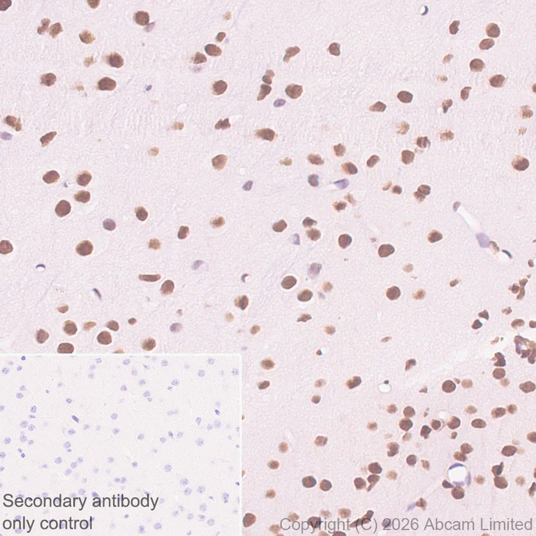 Immunohistochemistry (Formalin/PFA-fixed paraffin-embedded sections) - Anti-MTA1 antibody [EPR26320-543] (AB326880)
