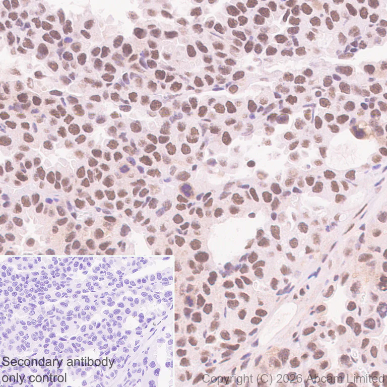 Immunohistochemistry (Formalin/PFA-fixed paraffin-embedded sections) - Anti-MTA1 antibody [EPR26320-543] (AB326880)