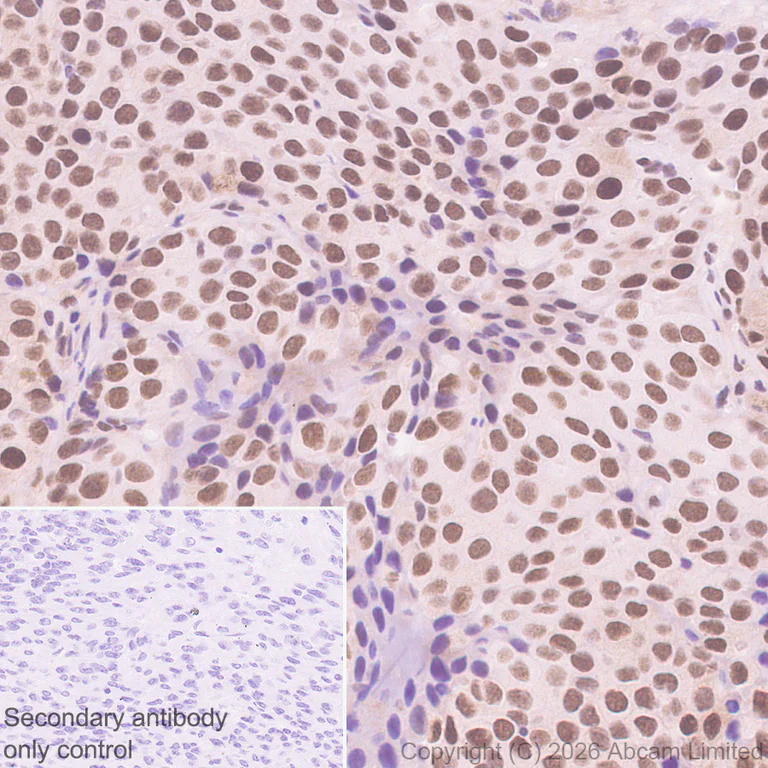 Immunohistochemistry (Formalin/PFA-fixed paraffin-embedded sections) - Anti-MTA1 antibody [EPR26320-543] (AB326880)