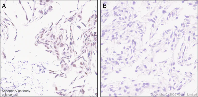 Immunohistochemistry (Formalin/PFA-fixed paraffin-embedded sections) - Anti-MTA1 antibody [EPR26320-543] (AB326880)