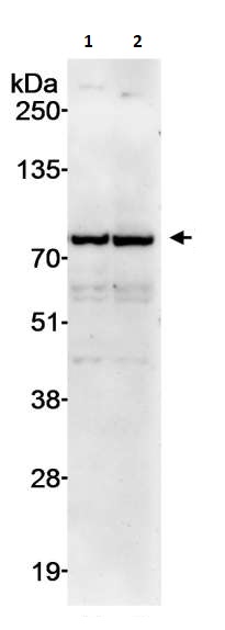 Western blot - Anti-MTA2/PID antibody (AB264123)