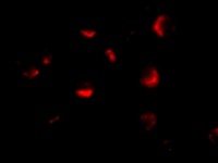 Immunocytochemistry/ Immunofluorescence - Anti-MTA2/PID antibody (AB8106)