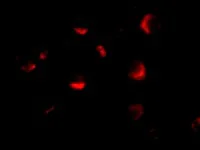 Immunocytochemistry/ Immunofluorescence - Anti-MTA2/PID antibody (AB8106)