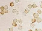 Immunocytochemistry/ Immunofluorescence - Anti-MTA2/PID antibody (AB8106)