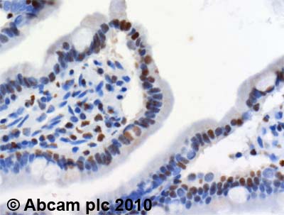 Immunohistochemistry (Formalin/PFA-fixed paraffin-embedded sections) - Anti-MTA2/PID antibody (AB8106)