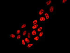 Immunocytochemistry/ Immunofluorescence - Anti-MTA2/PID antibody [EPR8537(2)] (AB171073)