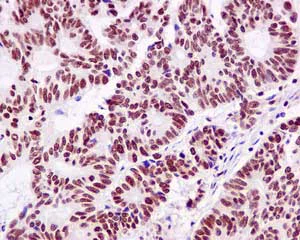 Immunohistochemistry (Formalin/PFA-fixed paraffin-embedded sections) - Anti-MTA2/PID antibody [EPR8537(2)] (AB171073)
