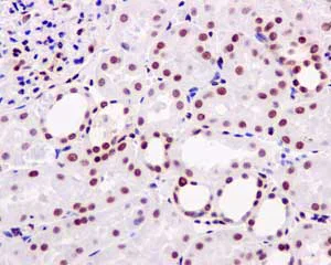 Immunohistochemistry (Formalin/PFA-fixed paraffin-embedded sections) - Anti-MTA2/PID antibody [EPR8537(2)] - BSA and Azide free (AB249629)