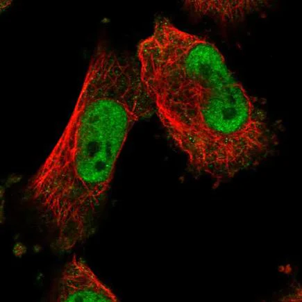 Immunocytochemistry/ Immunofluorescence - Anti-MTA3 antibody (AB243587)