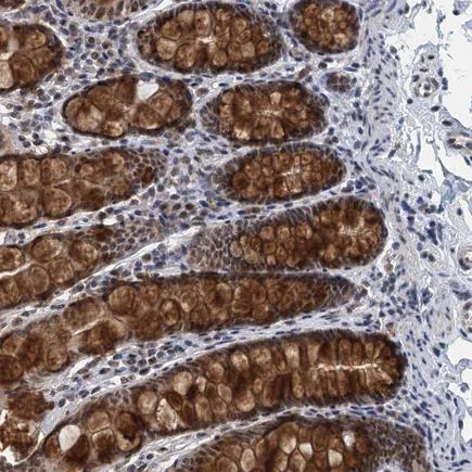 Immunohistochemistry (Formalin/PFA-fixed paraffin-embedded sections) - Anti-MTA3 antibody (AB243587)