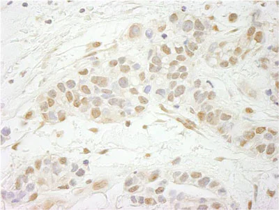 Immunohistochemistry (Formalin/PFA-fixed paraffin-embedded sections) - Anti-MTA3 antibody (AB87275)