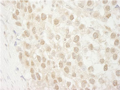 Immunohistochemistry (Formalin/PFA-fixed paraffin-embedded sections) - Anti-MTA3 antibody (AB87275), expandable thumbnail