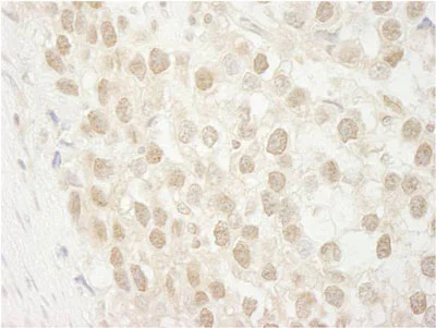 Immunohistochemistry (Formalin/PFA-fixed paraffin-embedded sections) - Anti-MTA3 antibody (AB87275)