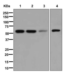 Western blot - Anti-MTA3 antibody [EPR12777(B)] (AB176346), expandable thumbnail