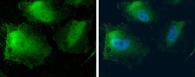 Immunocytochemistry/ Immunofluorescence - Anti-MTAP antibody (AB96231)