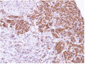 Immunohistochemistry (Formalin/PFA-fixed paraffin-embedded sections) - Anti-MTAP antibody (AB96231)