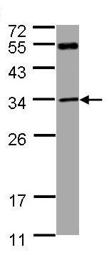 Western blot - Anti-MTAP antibody (AB96231), expandable thumbnail