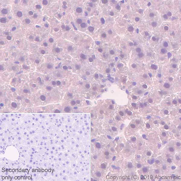 Immunohistochemistry (Formalin/PFA-fixed paraffin-embedded sections) - Anti-MTAP antibody [EPR22570-76] (AB254265)