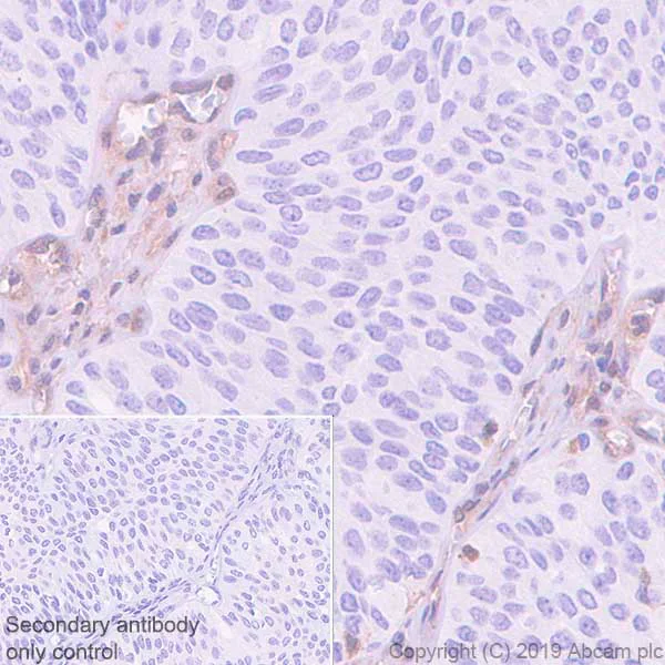 Immunohistochemistry (Formalin/PFA-fixed paraffin-embedded sections) - Anti-MTAP antibody [EPR22570-76] - BSA and Azide free (AB256356)