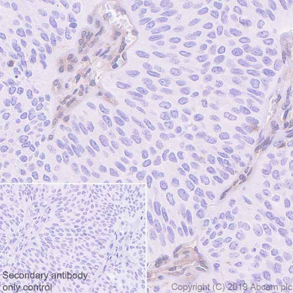 Immunohistochemistry (Formalin/PFA-fixed paraffin-embedded sections) - Anti-MTAP antibody [EPR22574-104] (AB252934)