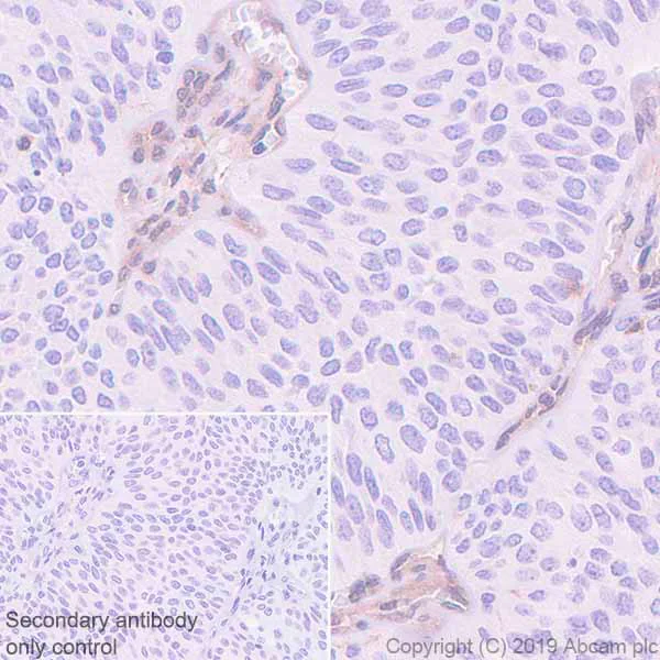 Immunohistochemistry (Formalin/PFA-fixed paraffin-embedded sections) - Anti-MTAP antibody [EPR22574-104] - BSA and Azide free (AB256358)