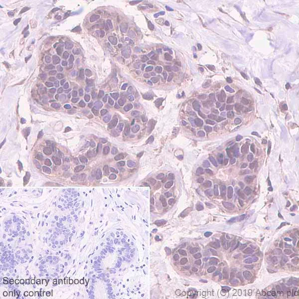 Immunohistochemistry (Formalin/PFA-fixed paraffin-embedded sections) - Anti-MTAP antibody [EPR22574-104] - BSA and Azide free (AB256358)
