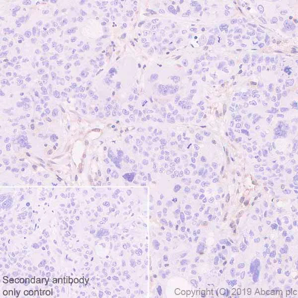 Immunohistochemistry (Formalin/PFA-fixed paraffin-embedded sections) - Anti-MTAP antibody [EPR22574-104] - BSA and Azide free (AB256358)