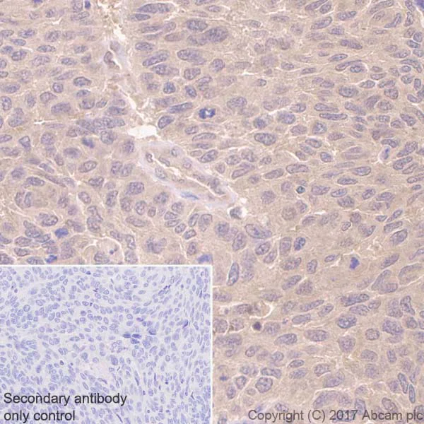 Immunohistochemistry (Formalin/PFA-fixed paraffin-embedded sections) - Anti-MTAP antibody [EPR6893] (AB126770)