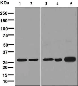Western blot - Anti-MTAP antibody [EPR6893] (AB126770)