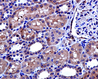 Immunohistochemistry (Formalin/PFA-fixed paraffin-embedded sections) - Anti-MTAP antibody [EPR6893] - BSA and Azide free (AB232417)