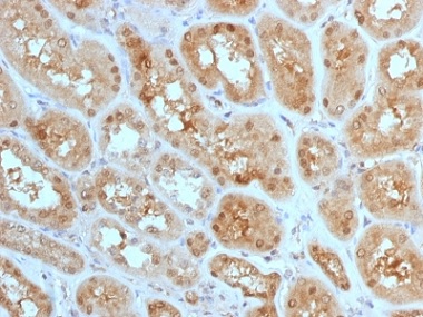 Immunohistochemistry (Formalin/PFA-fixed paraffin-embedded sections) - Anti-MTAP antibody [MTAP/1813] - BSA and Azide free (AB237868)