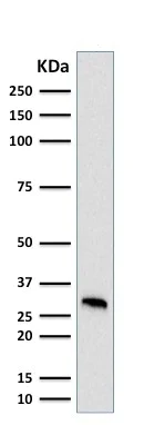 Western blot - Anti-MTAP antibody [MTAP/1813] - BSA and Azide free (AB237868)
