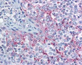 Immunohistochemistry (Formalin/PFA-fixed paraffin-embedded sections) - Anti-MTBP antibody (AB115529), expandable thumbnail
