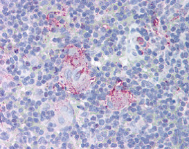 Immunohistochemistry (Formalin/PFA-fixed paraffin-embedded sections) - Anti-MTBP antibody (AB115529), expandable thumbnail