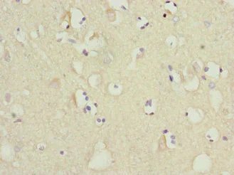 Immunohistochemistry (Formalin/PFA-fixed paraffin-embedded sections) - Anti-MTCH1/PSAP antibody (AB230006)