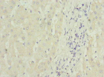 Immunohistochemistry (Formalin/PFA-fixed paraffin-embedded sections) - Anti-MTCH1/PSAP antibody (AB230006)