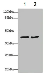 Western blot - Anti-MTCH1/PSAP antibody (AB230006)