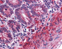 Immunohistochemistry (Formalin/PFA-fixed paraffin-embedded sections) - Anti-MTCH2 antibody (AB113707)