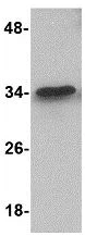 Western blot - Anti-MTCH2 antibody (AB113707)