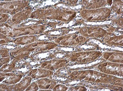 Immunohistochemistry (Formalin/PFA-fixed paraffin-embedded sections) - Anti-MTCH2 antibody (AB227926)