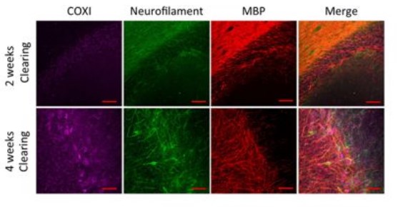 Immunohistochemistry (Formalin/PFA-fixed paraffin-embedded sections) - Anti-MTCO1 antibody [1D6E1A8] (AB14705), expandable thumbnail