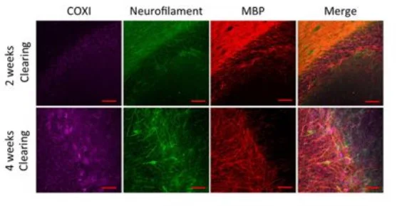 Immunohistochemistry (Formalin/PFA-fixed paraffin-embedded sections) - Anti-MTCO1 antibody [1D6E1A8] - BSA and Azide free (AB309362)